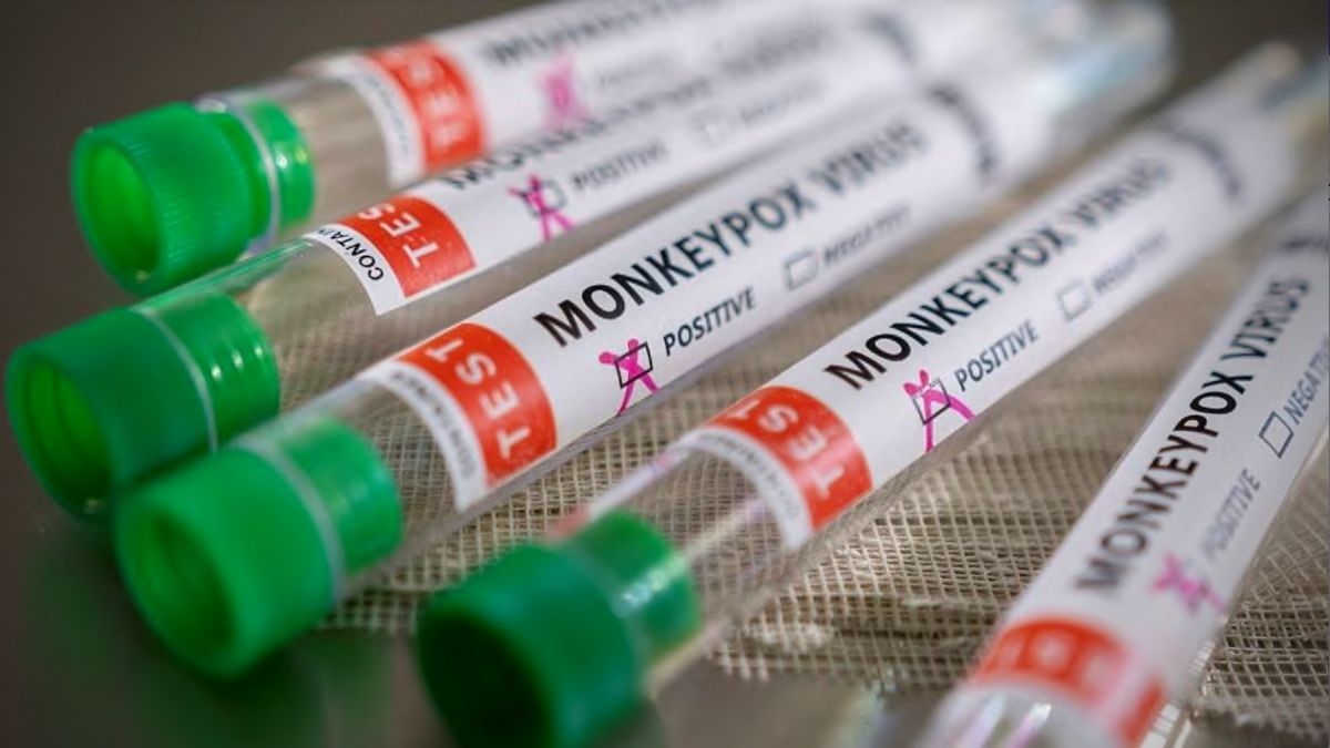 After COVID-19, now vaccination against Monkeypox?