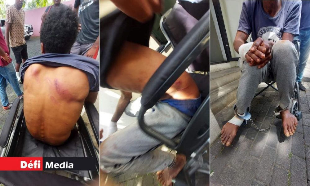 More images emerge of alleged police brutality after manhunt