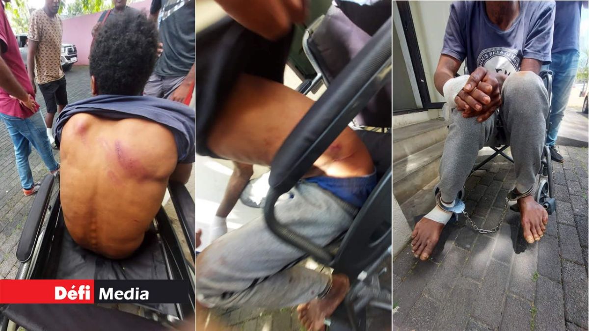 More images emerge of alleged police brutality after manhunt