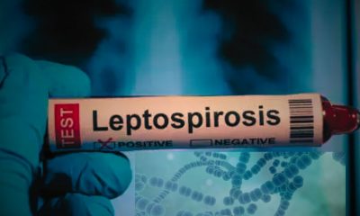 Another Victim: Leptospirosis Strikes Again, 7 Lives Lost