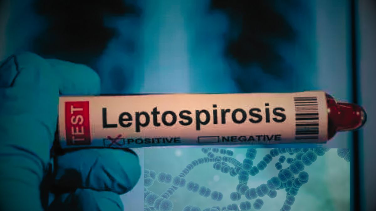 Another Victim: Leptospirosis Strikes Again, 7 Lives Lost
