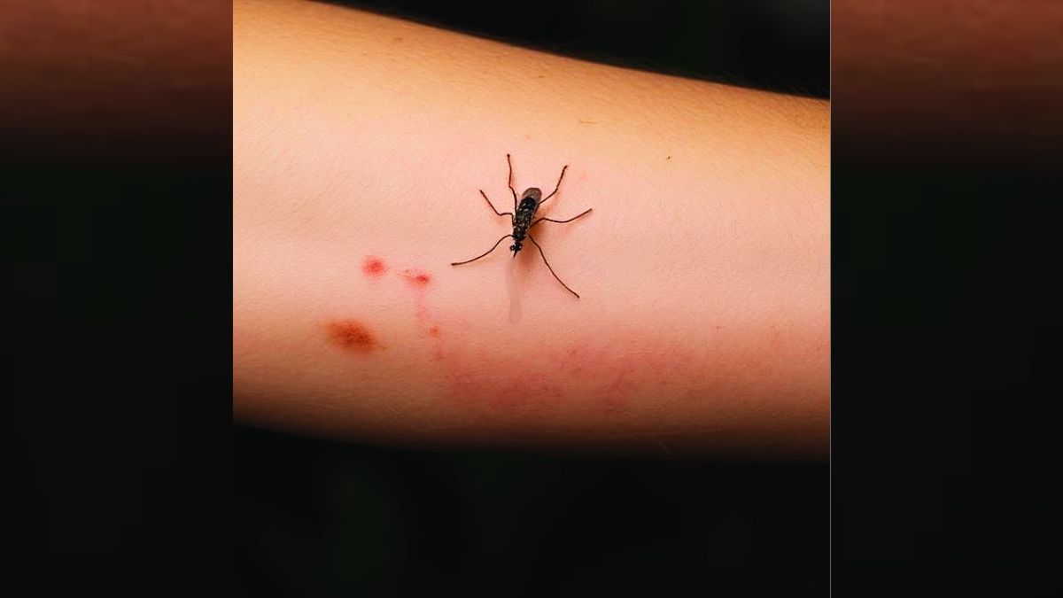 Rising Cases: 12 Dengue, 13 Chikungunya Infections Confirmed