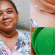 Doctors Track 24mm Wire Wedged between Vital Neck Arteries to Save Mauritian Patient